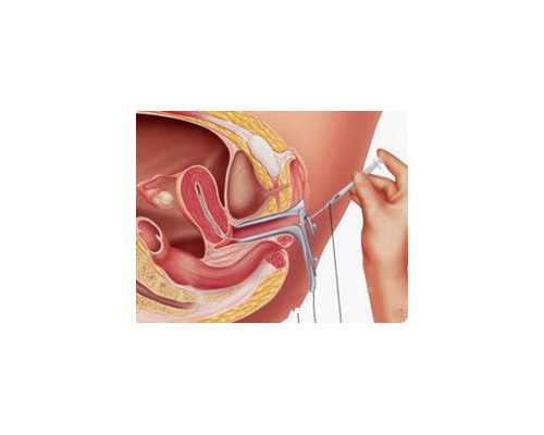 【南京供卵生男孩试管医院】南京妇幼试管医生排名