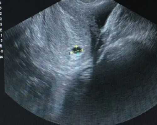 南京三代试管助孕生子 2024南京鼓楼医院供精试管婴儿费用 ‘彩超数据男女’