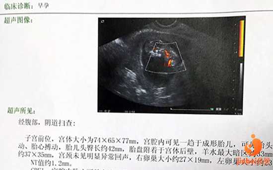 南京供卵专业医院排名_【广州卵巢早衰供卵电话】同时希望想要宝宝的姐妹们