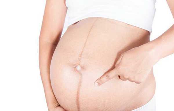 妊娠线分男女怎么看？还可以怎么辨别宝宝性别？